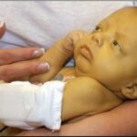 Jaundiced-newborn-in-arm-1
